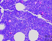 B淋巴细胞 B淋巴细胞